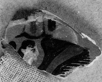HYDRIA, FRAGMENTS (ATHENIAN, BLACK-FIGURE)