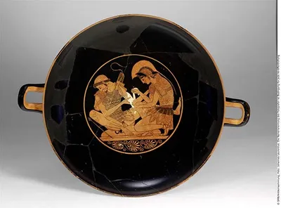 Trinkschale (Attische Trinkschale)