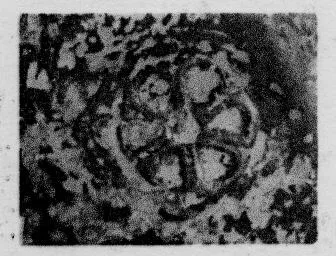 CUP, STEMLESS, FRAGMENT (SOUTH ITALIAN, CAMPANIAN, RELIEF)