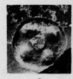 CUP, STEMLESS, FRAGMENT (SOUTH ITALIAN, CAMPANIAN, RELIEF)