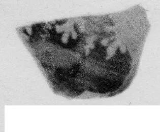 CUP, STEMLESS, FRAGMENT (SOUTH ITALIAN, CAMPANIAN, BLACK GLAZE)