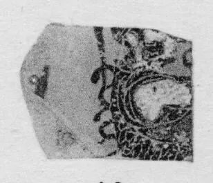 HYDRIA, FRAGMENTS (ATHENIAN, BLACK-FIGURE)