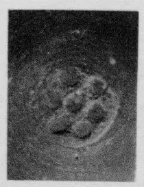 CUP, STEMLESS, FRAGMENT (SOUTH ITALIAN, CAMPANIAN, RELIEF)