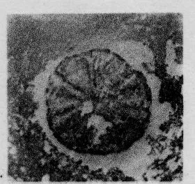 CUP, STEMLESS, FRAGMENT (SOUTH ITALIAN, CAMPANIAN, RELIEF)