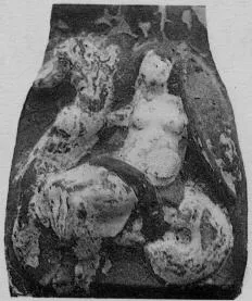 AMPHORA, BELLY (ATHENIAN, BLACK GLAZE)
