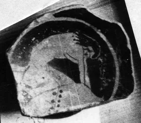 CUP (ATHENIAN, RED-FIGURE)