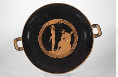 Schale (Attische Trinkschale)