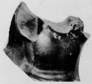 CUP, STEMLESS, FRAGMENT (SOUTH ITALIAN, CAMPANIAN, BLACK GLAZE)