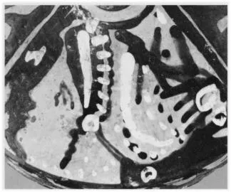 LEKANIS (SOUTH ITALIAN, APULIAN, RED-FIGURE)