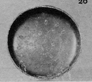 DISH (ATHENIAN, BLACK GLAZE)