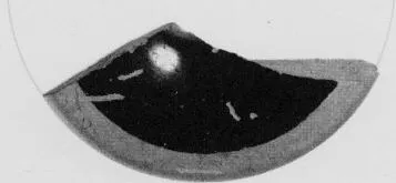 CUP, FRAGMENT (ATHENIAN, RED-FIGURE)