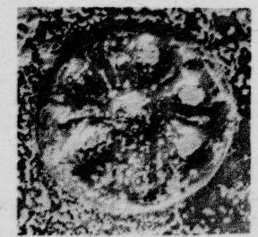 CUP, STEMLESS, FRAGMENT (SOUTH ITALIAN, CAMPANIAN, RELIEF)